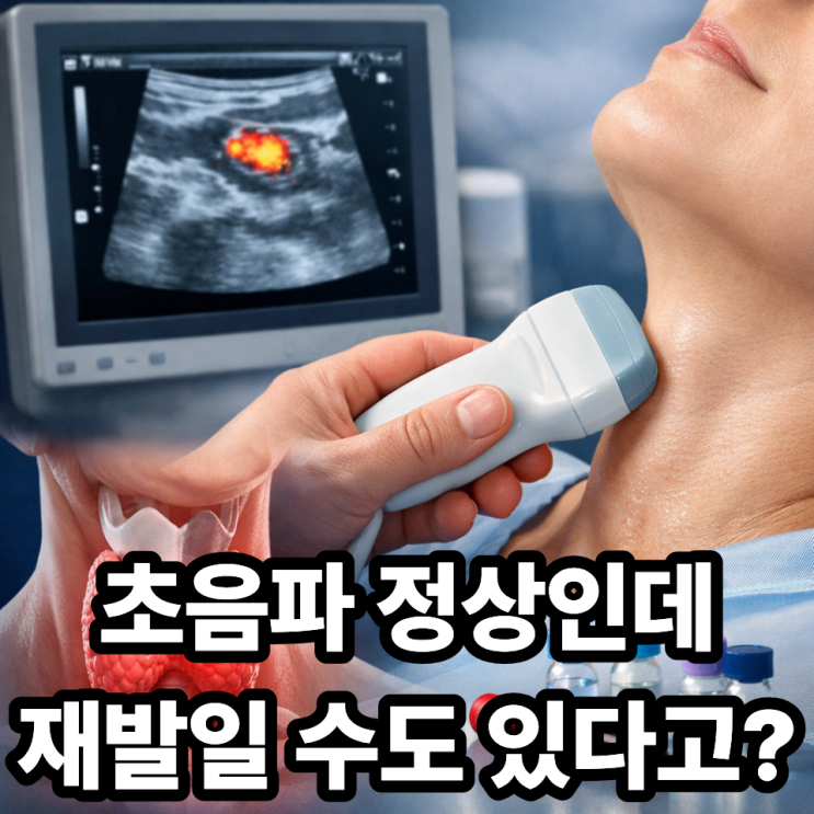  갑상선암 재발 검사, 초음파만으로 충분할까? 꼭 알아야 할 검사 범위