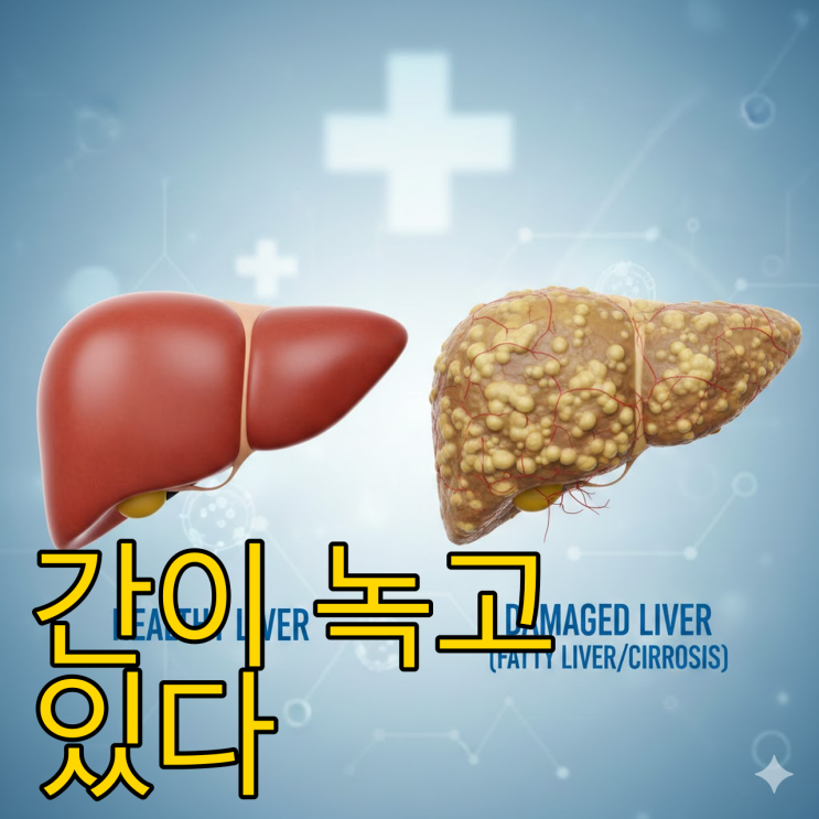  간수치 폭탄, 약 먹기 전 '이것'부터 챙기세요