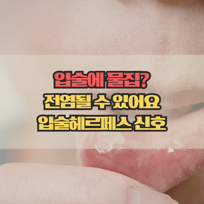  입술헤르페스, 초기 증상부터 전염 위험까지 정리