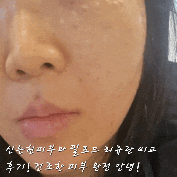  신논현피부과 필로드 리쥬란 비교 후기! 건조한 피부 완전 안녕!