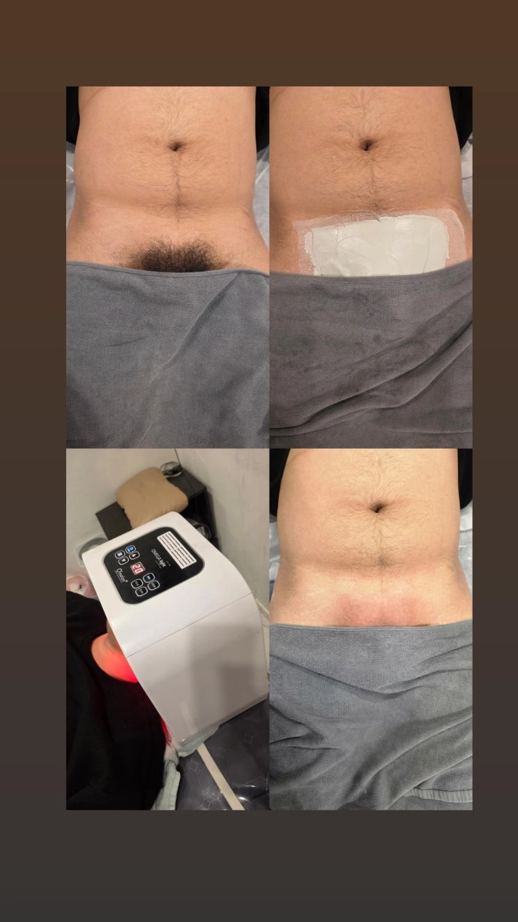  남자 브라질리언 왁싱은 남자 왁서가 맞춤 케어해 드리는 영등포 남자 왁싱샵 "청춘케어"