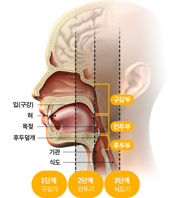  거의 20년은 넘게 고생한 어머니의 물마시다 기절,[삼킴장애] 해결..