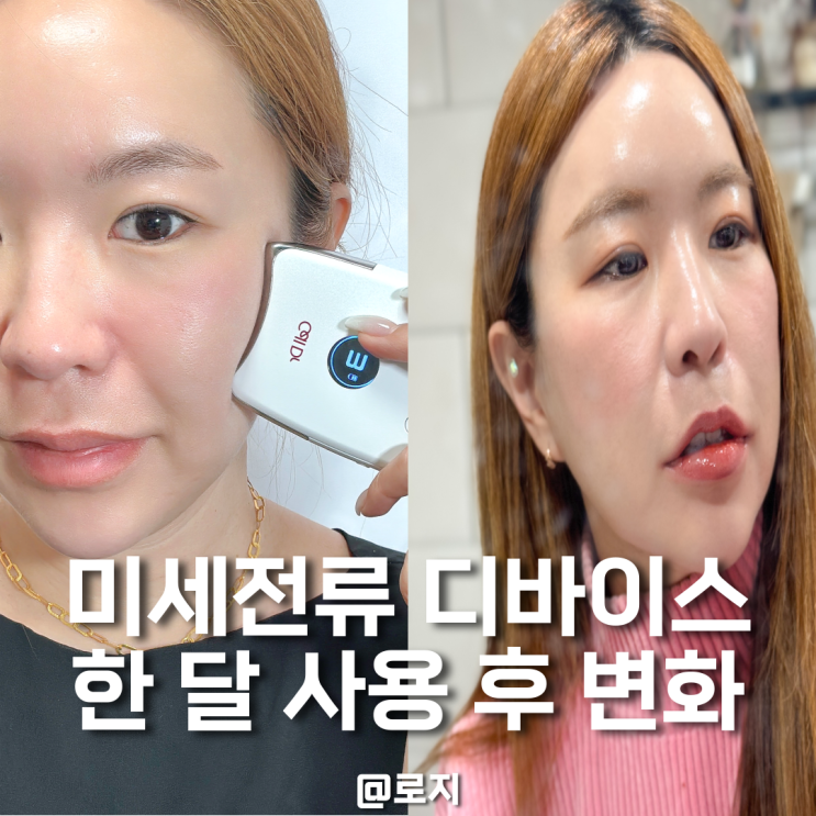  미세전류 리프팅 뷰티 디바이스 보떼누보 셀닥터 한 달 사용 변화