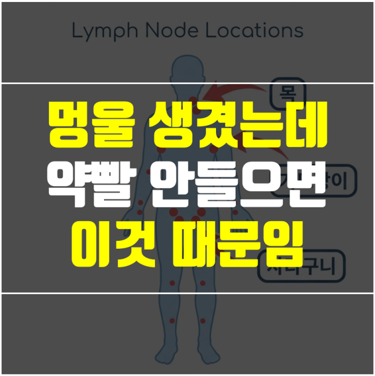  임파선염 멍울이 목에 만져질 때, 당뇨 환자가 더 위험한 3가지 이유