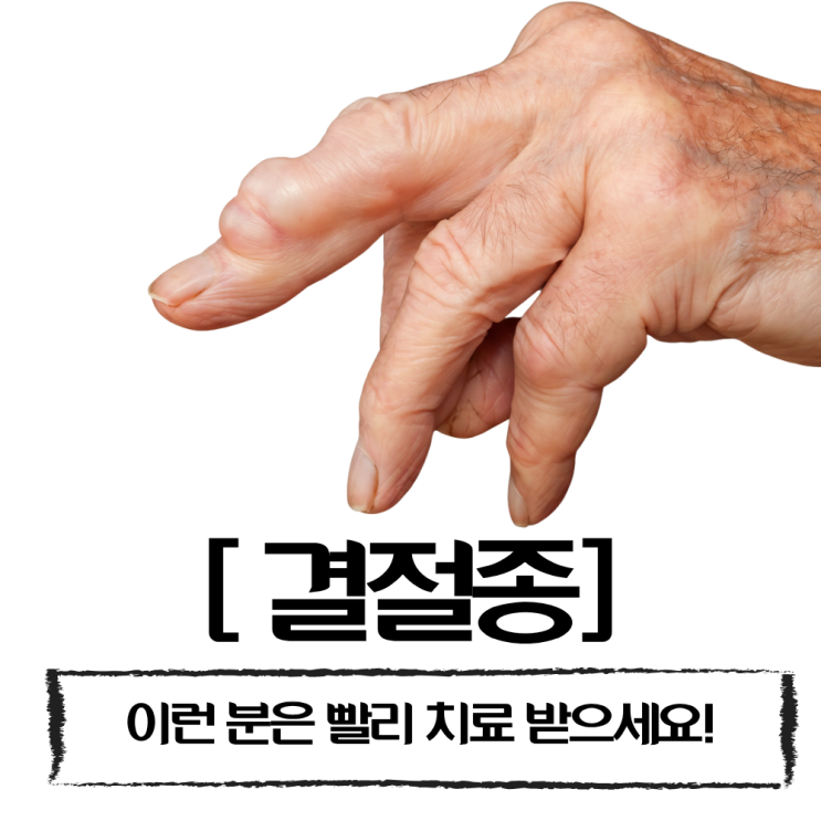  손목에 혹 결절종? 지방종? 결절종 수술없는 치료는