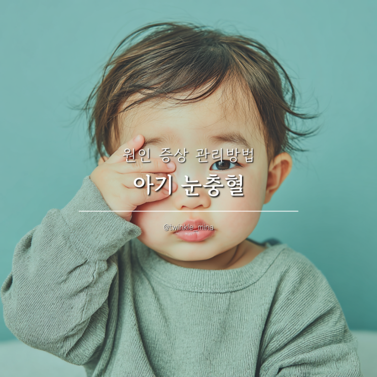  아기 눈충혈 원인 증상 집에서 할 수 있는 관리방법