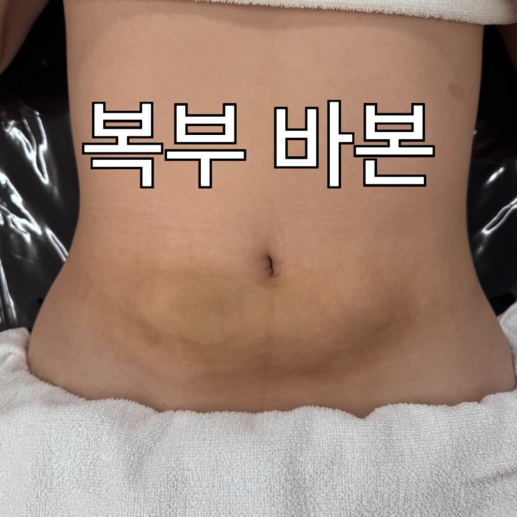  바본관리 언제부터 해야 할까요?