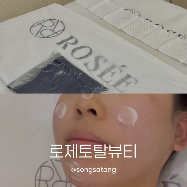  과천피부관리 로제토탈뷰티 여드름 색소침착 케어 좋아졌어요