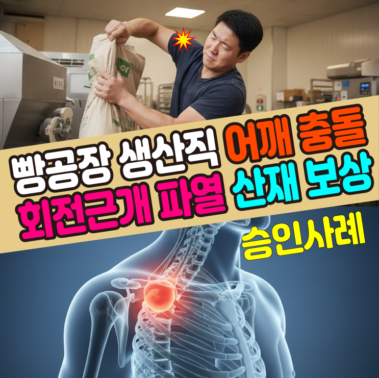  [대구 노무사] 제빵공장 생산직 어깨 충돌증후군, 회전근개 파열 수술 산재 보상사례