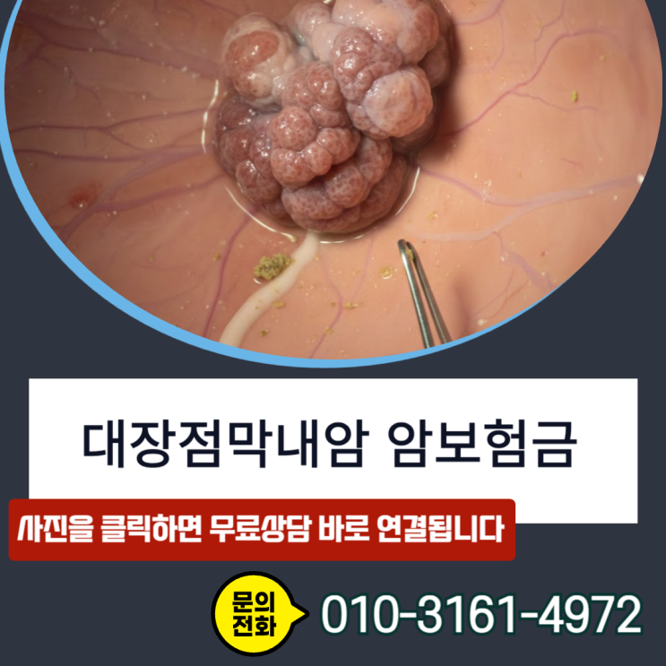  대장점막내암 암보험금, 전액 수령의 열쇠는 이것입니다