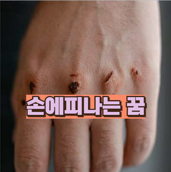 손에피나는꿈 해몽 알고 나면 은근 소름돋는 부분