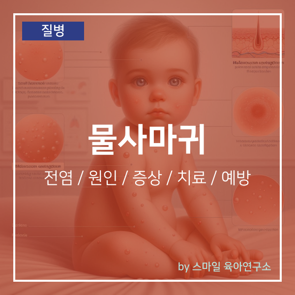아기 물사마귀 전염 원인 및 증상 치료 방법