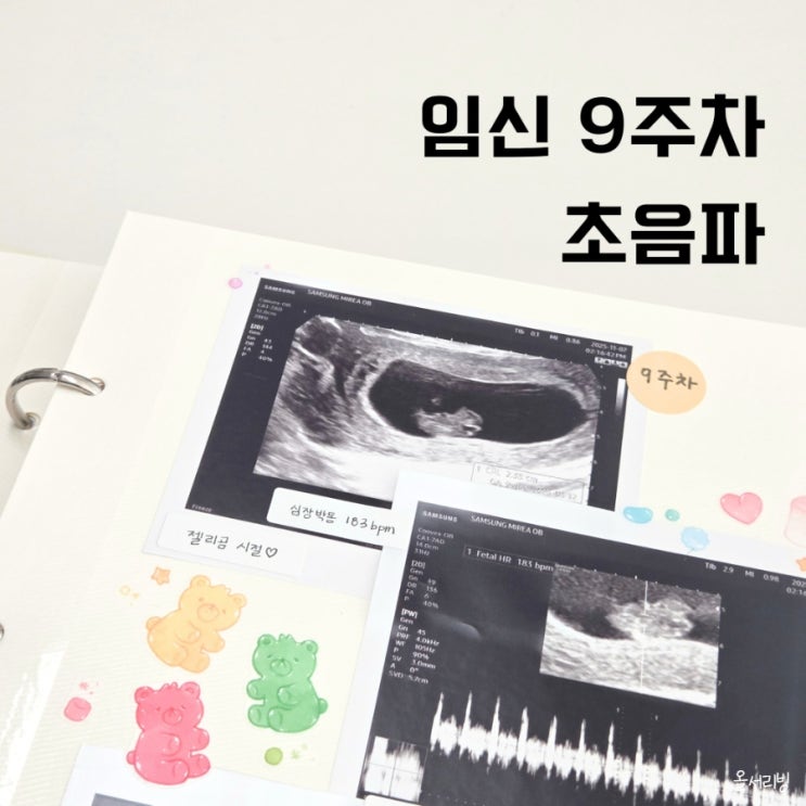  임신 9주차 증상 배 초음파 젤리곰 심박수 입덧 피크