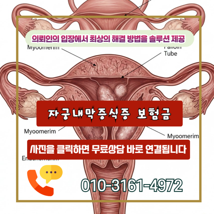  자궁내막증식증 보험금, 놓치기 쉬운 이것 하나로 보상액이 천만원 넘게 차이 납니다