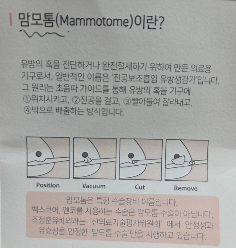 수원 망포 | 맘모톰 시술, 흉터 걱정 없는 안전한 유방 혹 제거 후기 – 조정훈 유바외과