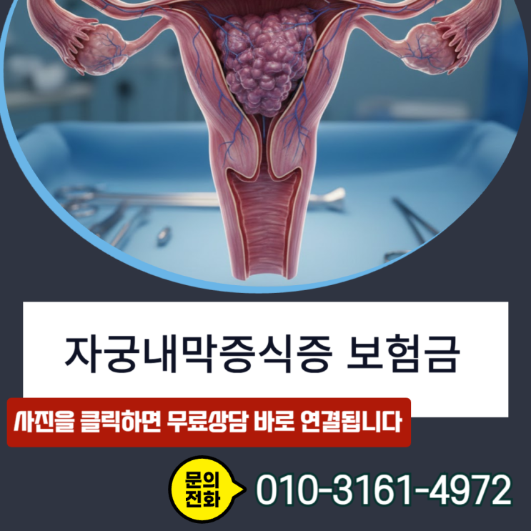  자궁내막증식증 보험금, N85 코드로도 암 진단비 받는 방법 공개