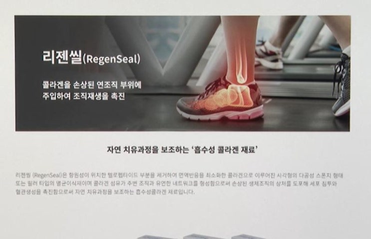 무릎주사 입원 실손보험, 될까 안 될까…법원 판결은? [SBS Biz]