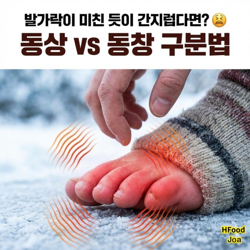 겨울철 발가락 간지러움, 동상일까 동창일까? 붉게 붓는 증상 해결법 (ft. 족욕 온도)