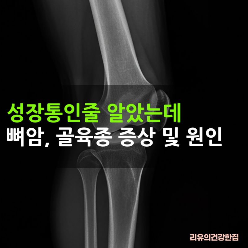 골육종 증상, 골육종암 원인 및 치료