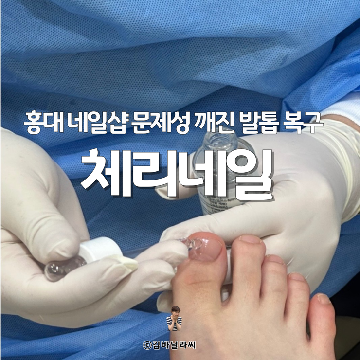  홍대 내성 발톱 문제성 깨진발톱 복구 체리네일