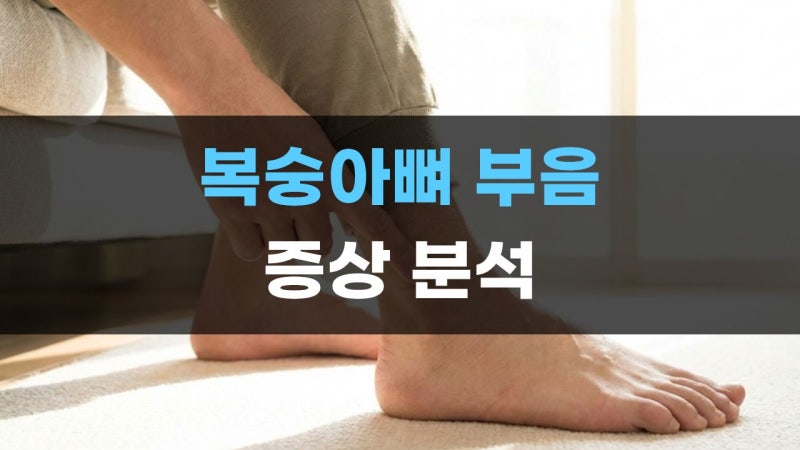 안쪽 옆 밑 복숭아뼈 부음 원인 통증 없음 간지러움 저림, 자가 진단법