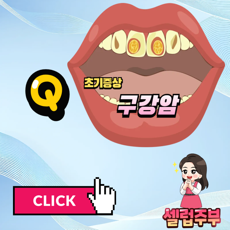 구강암 초기증상 조기 발견시 완치율 90%