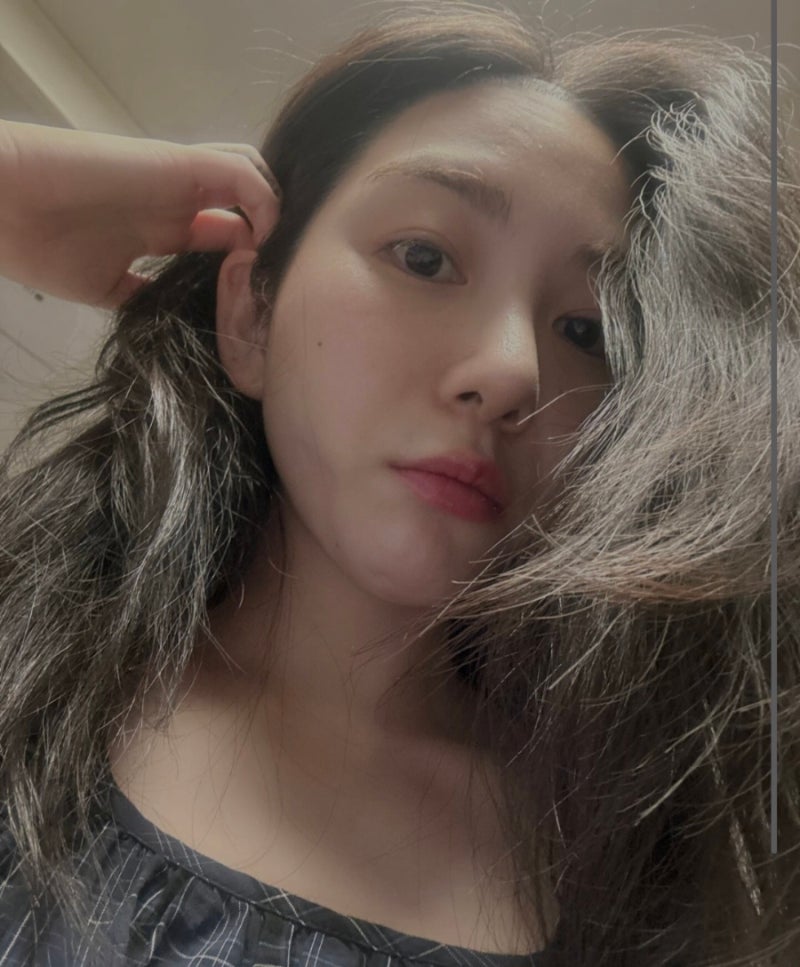 얼굴에 2도 화상 입은 AOA 출신 권민아는 누구? (프로필)
