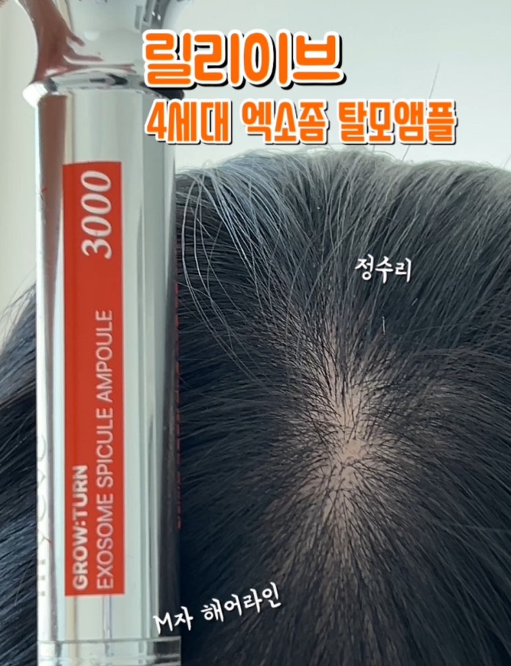  릴리이브 그로우턴 4세대 엑소좀 스피큘 탈모앰플 3000 사용후기