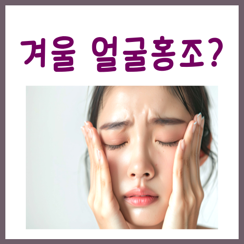  겨울 얼굴홍조, 이렇게 관리해 보세요
