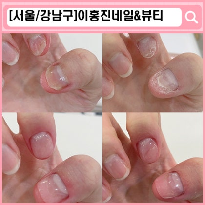 LCN라운지 강남압구정점 이홍진뷰티