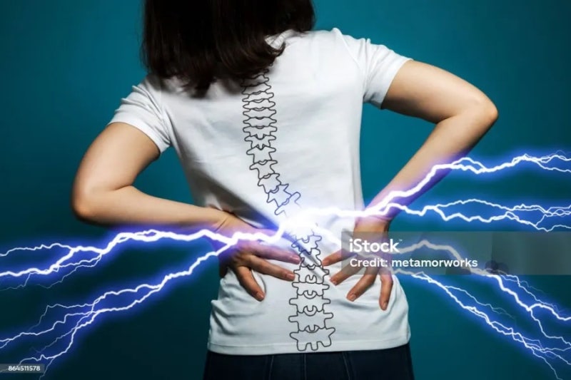 20대 허리디스크 파열 전조증상과 MRI 진단 후기 시술없는 보존치료 결심