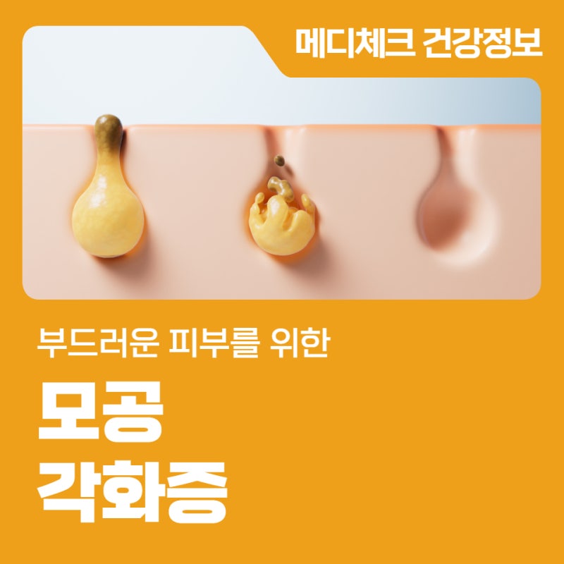 부드러운 피부를 위한 모공각화증