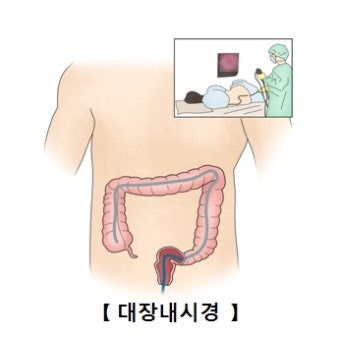 대장 용종 제거 실비보험 청구 구비서류 안내