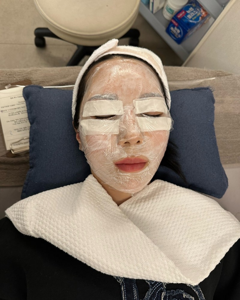[명동 피부과] 얼굴 전체 점제거, 편평사마귀 비립종 한관종 제거 후기 1탄 내돈내산 후기