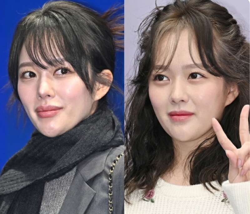 얼굴 왜 이래? 정지소 확 달라진 외모에 네티즌 갑론을박 (외모변천사)