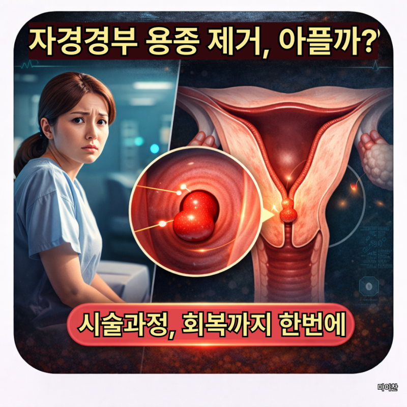 자궁경부 용종, 꼭 떼어야 할까? 시술·회복 한 번에 정리