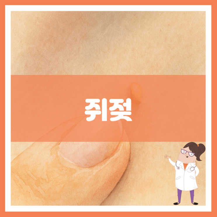  쥐젖 원인 증상 치료