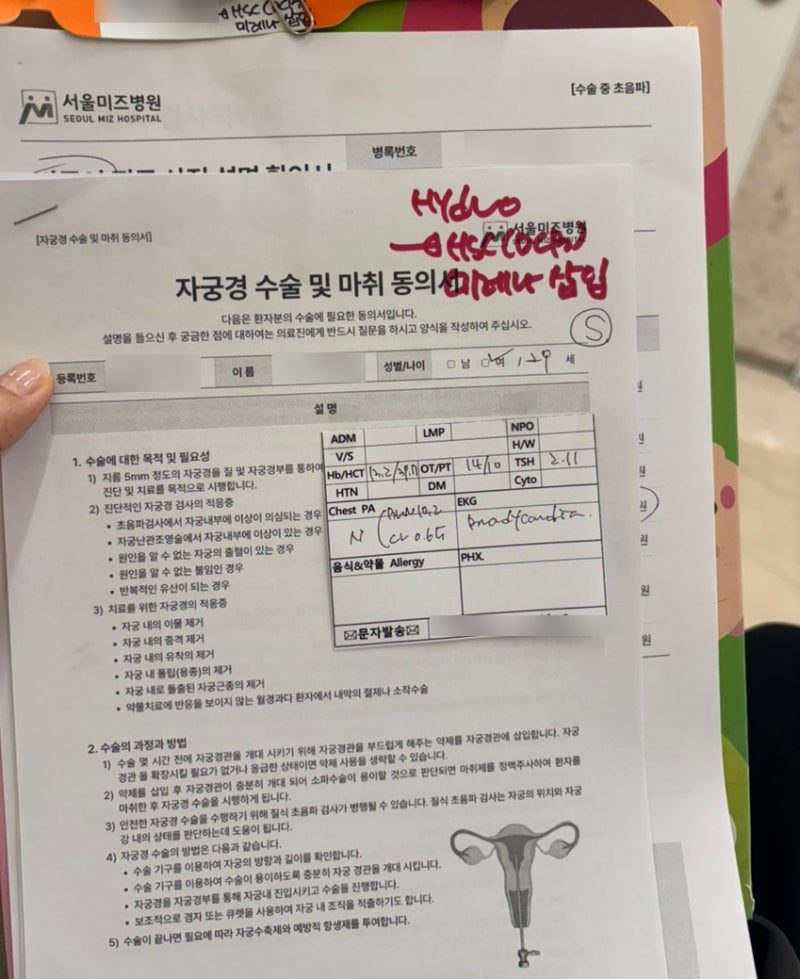 30대 전신마취 자궁소파술+미레나 삽입 4개월차 : 출혈/통증/체중증가