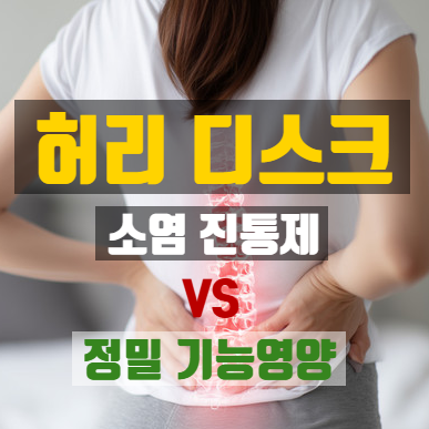 허리디스크 통증, 요통에 좋은 영양제와 소염 진통제