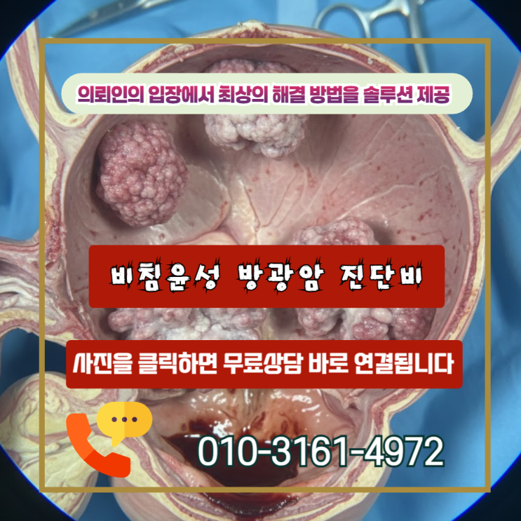  비침윤성 방광암 진단비, C67인데 소액암? 손해사정사가 알려주는 핵심 전략