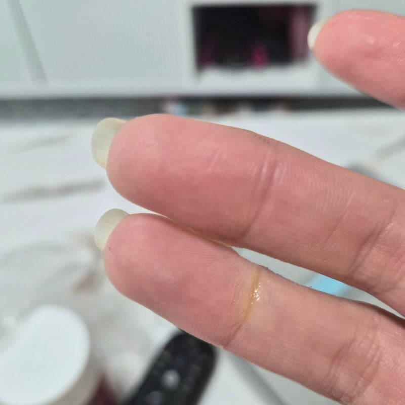 손이 순간접착제에 붙었을 때