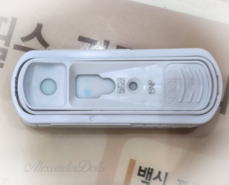  ProBNP 했으면 HCM 검사 끝?｜고양이 심장검사 오해 정리 (ProBNP·유전자·초음파 차이)