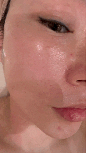  김포피부관리 40대중반 운양동 담온에스테틱에서 느낀 피부 변화 기록