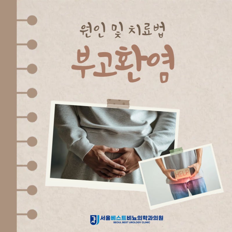 부고환염 원인 및 심각해지지 않기 위한 치료법