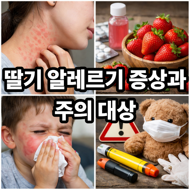  딸기 알레르기 증상과 주의 대상  가볍게 넘기면 안 되는 이유