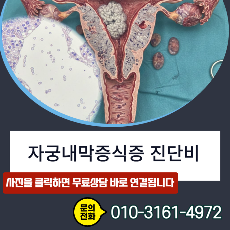  자궁내막증식증 진단비, 조직검사지 속 Atypical 확인하셨나요?