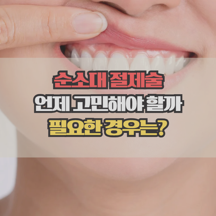  순소대 절제술이란? 필요한 경우와 시기 한눈에 정리
