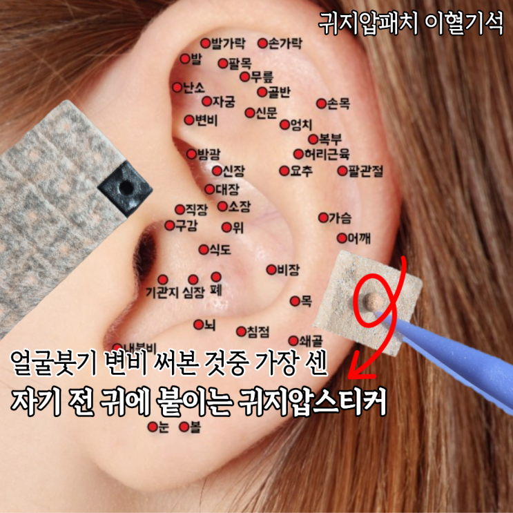  써본것중 제일 쎈놈 귀지압스티커 헬씨이어 이혈기석 후기(귀지압점 손혈자리 붓기빼기 위치)