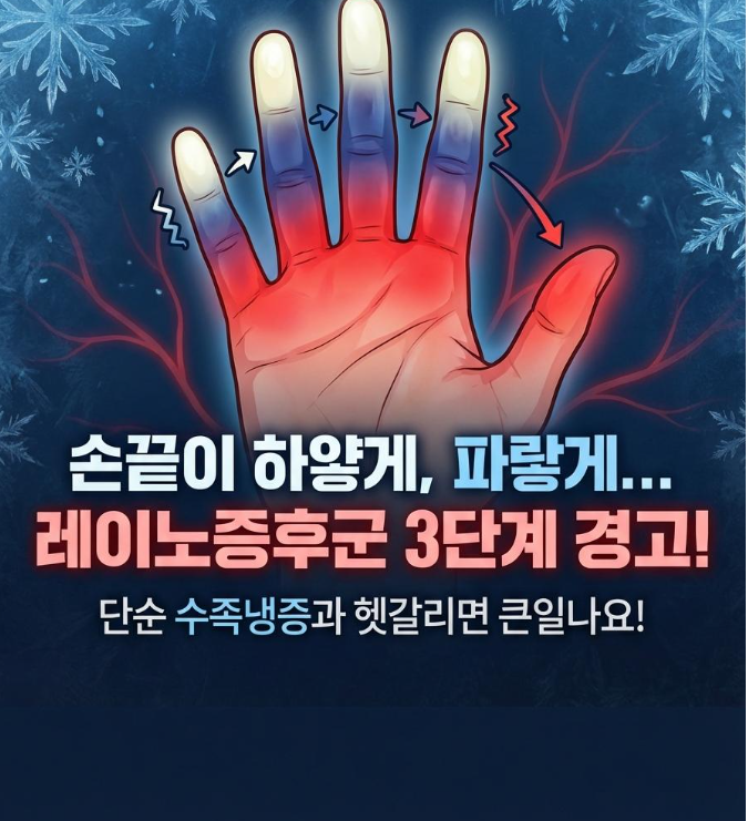 레이노증후군 증상 총정리｜손발 색깔 변화 3단계와 수족냉증 차이