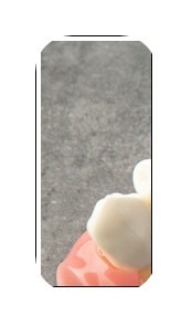 김포 구래치과 임플란트 재수술 즉시 확인해봐야